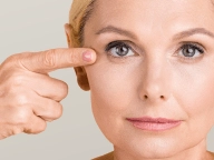 Blefaroplastia.